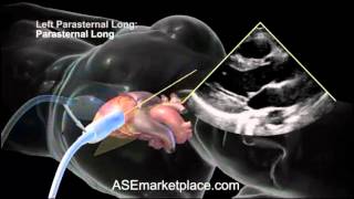 How to do a Basic Transthoracic Echocardiogram Transducer Position and Anatomy [upl. by Notreb510]