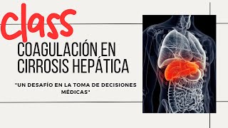 COAGULACIÓN EN CIRROSIS HEPÁTICA Un desafío en la toma de decisiones médicas [upl. by Ydnahs]