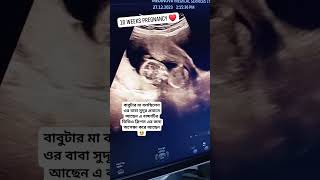 16 Weeks Pregnancy Ultrasonogram  ১৬ সপ্তাহের আলট্রাসোনোগ্রাম কেমন হয় ultrasound pregnancyscan [upl. by Eliason]