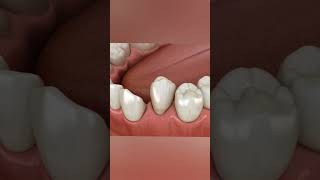 dental teeth animation viral shorts health motivation 3d fitness gym 3danimation anatomy [upl. by Amata]