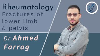 Rheumatology I Fractures of lower limb and pelvis I Dr Ahmed Farrag [upl. by Anoy]