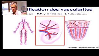 Web conférence sur les vascularites systémiques [upl. by Jerri]