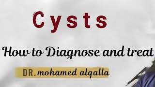 Cyst  How to diagnose and treat [upl. by Pedrick]