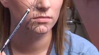 BOTOX PLANO DALLAS TUTORIAL LOWER FACE [upl. by Shull]