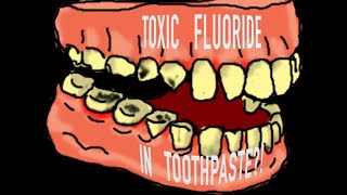 TOXIC Fluoride Present In Our Toothpastes And Water  Why Are Dentists Obsessed With it [upl. by Merideth]