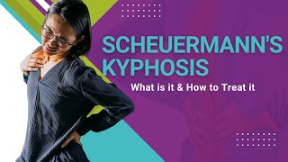 Scheuermanns Kyphosis  What is it amp How to Treat it [upl. by Enileuqkcaj]