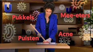 Waarom moet je een puist niet uitknijpen [upl. by Cyb892]