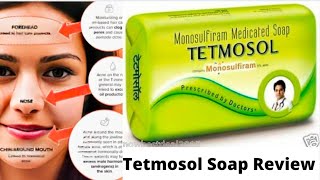 Tetmosol Soap ReviewMonosulfiram Medicated SoapTetmosol Soap Ki Jankari In Hindi Best Soap [upl. by Crowe]