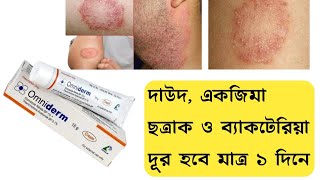 Omniderm Cream এর কাজ কি  দাউদ একজিমা চুলকানি ছত্রাক ও ব্যাকটেরিয়া দূর করার ভালো ক্রিম [upl. by Arahsit923]