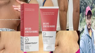 Dermatouch Bye Bye Stretch Marks Cream  Honest Review [upl. by Aliakam952]