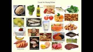 Best Foods to Prevent and Slow Down Osteoporosis [upl. by Livy]