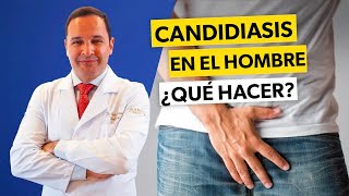 Cómo librarse de la CANDIDIASIS MASCULINA rápidamente [upl. by Mindy]