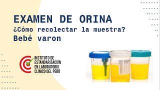 ¿Como recolectar la muestra de orina Bebé varón [upl. by Aver]