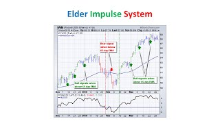 ระบบการเทรด Elder Impulse System [upl. by Namyac]