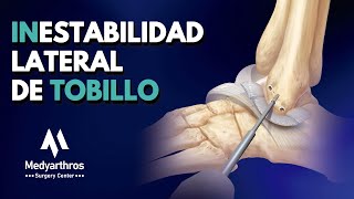 Inestabilidad Lateral de Tobillo [upl. by Libby]