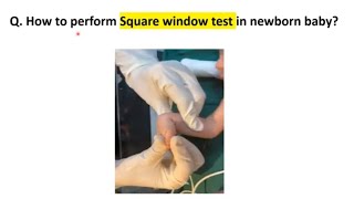 Square Window Test  Newborn Examination  Pediatrics [upl. by Brinna]