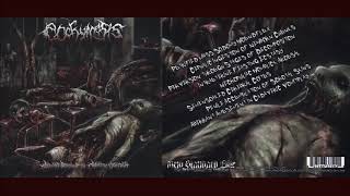 ecchymosis  ABERRANT AMUSEMENT IN CADAVERIC VOMITPLAY [upl. by Nellir504]