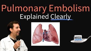 Pulmonary Embolism Explained Clearly  Risk factors Pathophysiology DVT Treatment [upl. by Everest]