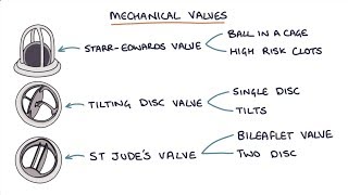 Prosthetic Heart Valves Visual Explanation for Students [upl. by Brentt]