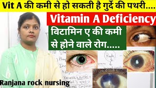 विटामिन ए की कमी से होने वाले रोग  What is vitamin A deficiency inhindi  nightblindness bitot spot [upl. by Ennaegroeg]