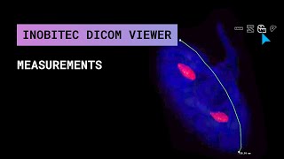 Inobitec DICOM Viewer Measurements [upl. by Sokairyk]