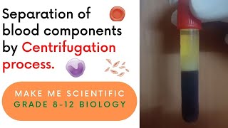 Centrifuging separating blood [upl. by Enilreug]