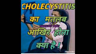 CHOLECYSTITIS Ka matlab kya hota hai Usg Gallbladder [upl. by Winebaum980]