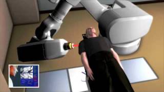 CyberKnife  Full Treatment Clip [upl. by Korenblat]