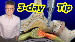 Physical Therapy after Lumbar Laminectomy 03 Day Secrets for Success [upl. by Obeded766]