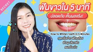 ฟันขาวใน5นาทีเห็นผลจริง วิธีแก้ฟันเหลืองง่ายๆ👄Whiten Teeth 5 minutes  แนน Sister Nan [upl. by Kelsy]