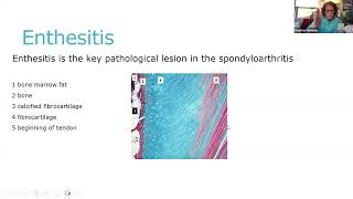 Rheumatology Physiotherapy UK axial Spondyloarthritis part 1  May 2024 [upl. by Assener]