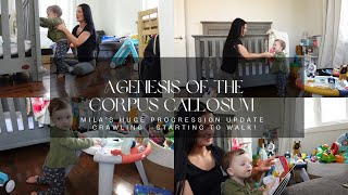 Agenesis of the Corpus Callosum  Mila’s HUGE PROGRESSION UPDATE  Crawling  Starting to WALK [upl. by Arvad]