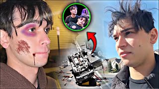 Lucas and Marcus  I Suffered A Serious Accident  Dobre Brother [upl. by Vanni]