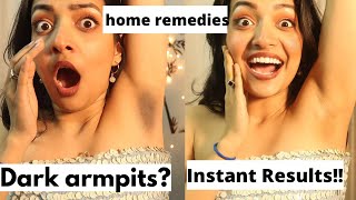 Home remedies to whiten your underarms in just one go  Yashasvi Rajpoot [upl. by Nyar]