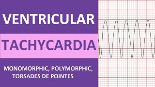 Ventricular Tachycardia Vtach ECG Interpretation Treatment Nursing NCLEX Review [upl. by Narual846]