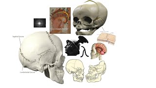 Anatomie du crane  sutures  points craniométriques et fontanelles [upl. by Marta]