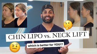 Chin Lipo Vs Deep Neck Lift which is better for YOU [upl. by Lednyk]