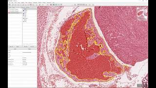 Tutorial  Using SCiLS Lab and QuPath to integrate mass spectrometry imaging with histology [upl. by Donaldson22]