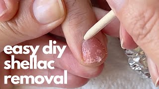 How to remove shellac at home Pro Nail Tech explains in detail [upl. by Carpet]