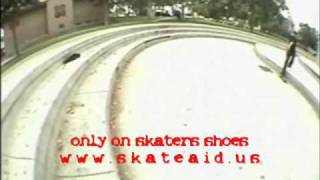 SKATEAID bucks story part 1 [upl. by Rossen]