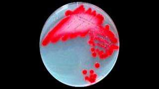 Serratia [upl. by Bishop]