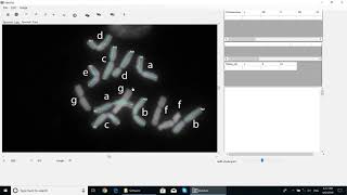 IdeoKar training videoFree karyotyping tool [upl. by Aisilef]