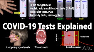 Understanding Different COVID19 Tests Animation [upl. by Aipotu703]