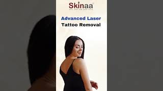 World’s best Laser Tattoo Removal Treatment at Skinaa Clinic viral shorts [upl. by Warren]