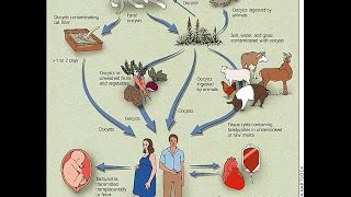 Congenital Toxoplasmosis [upl. by Kerstin]