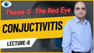 Conjunctivitis Lecture 6 [upl. by Ardua258]