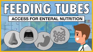 Types of Feeding Tubes EXPLAINED [upl. by Airehc409]