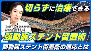 切らずに治療できる！頚動脈ステント留置術CASとは？脳神経外科医 吉村紳一Drが徹底解説！ [upl. by Lledraw572]