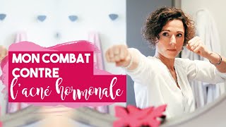 Mon PARCOURS MÉDICAL Contre LACNÉ HORMONALE Et Comment Je Men Suis Sortie [upl. by Aneerhs]