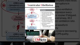 Ventricular Fibrillation VFib [upl. by Kipper453]